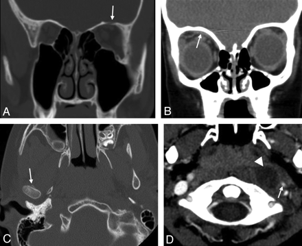 Fig 5.