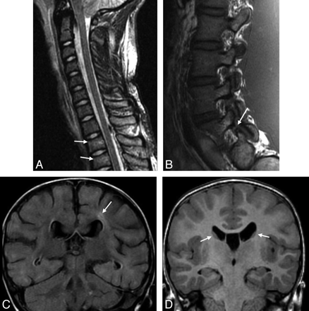 Fig 6.
