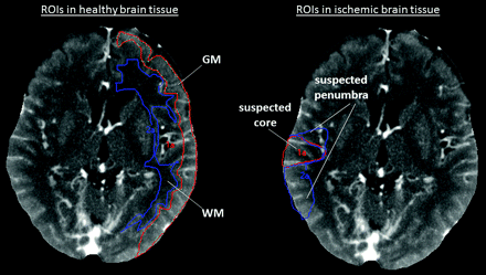 Fig 2.