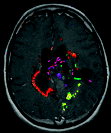 Fig 1.