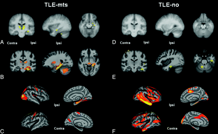 Fig 3.