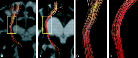 Fig 2.