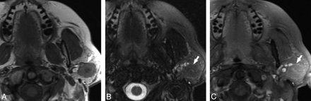 Fig 1.