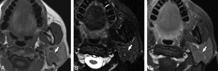 Fig 2.