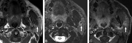 Fig 3.