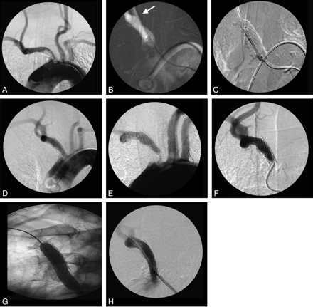 Fig 2.