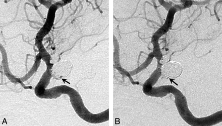 Fig 2.