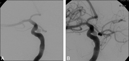 Fig 4.