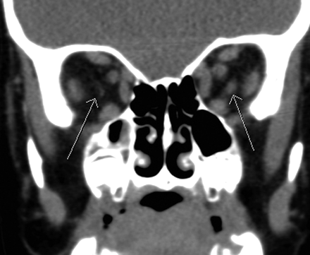 Fig 1.