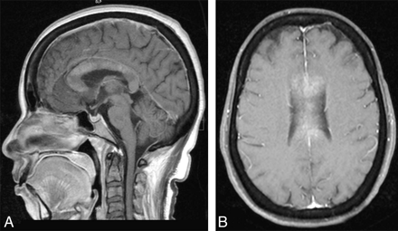 Fig 2.