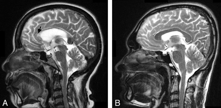 Fig 3.