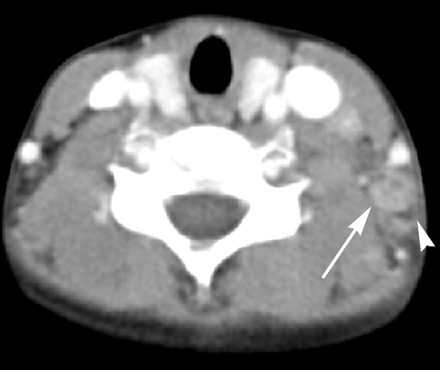 Fig 1.