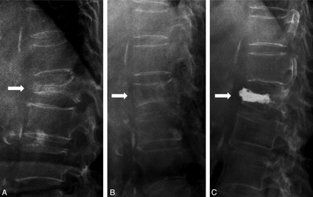 Fig 1.
