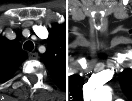 Fig 3.