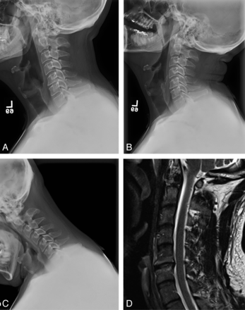Fig 1.
