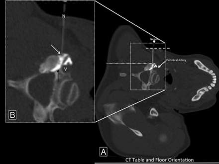 Fig 2.