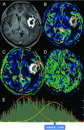 Fig 4.