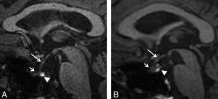 Fig 1.