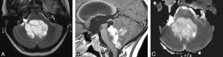 Fig 4.