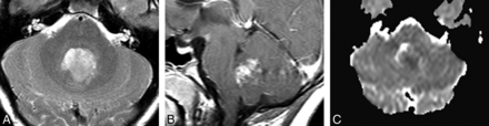 Fig 5.