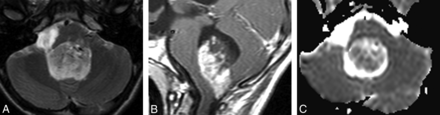 Fig 6.
