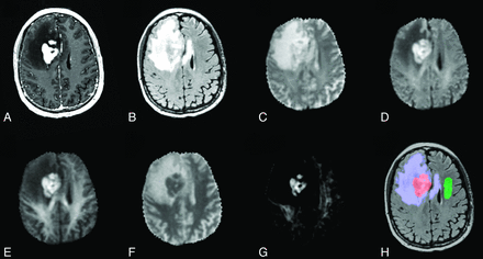 Fig 2.