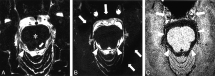Fig 2.