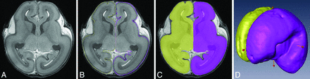 Fig 1.