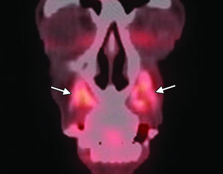 Fig 2.