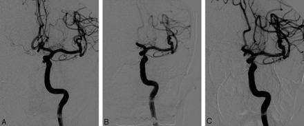Fig 1.