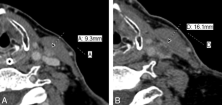 Fig 2.