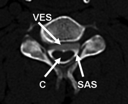 Fig 2.