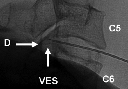 Fig 4.