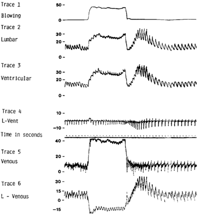 Fig 4.