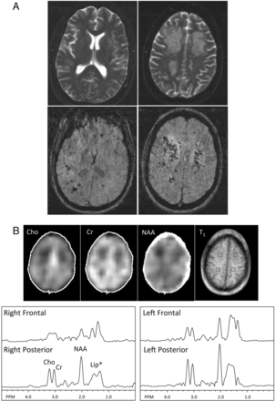 Fig 1.
