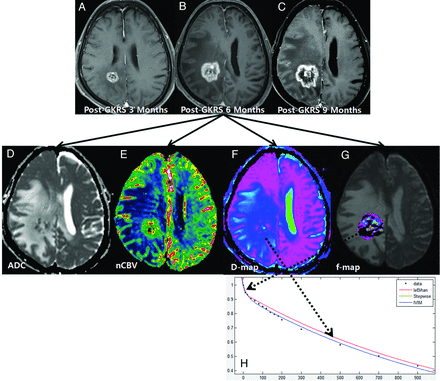 Fig 3.