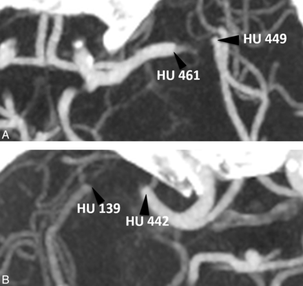 Fig 3.
