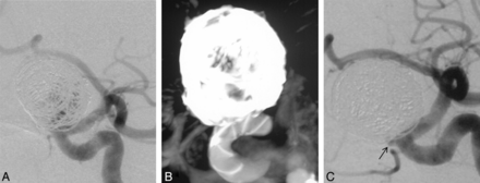 Fig 3.