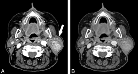 Fig 2.