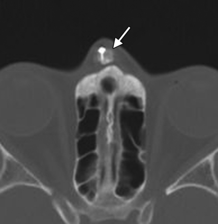 Fig 1.