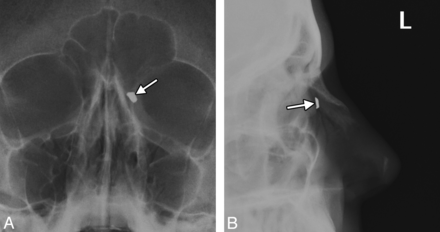 Fig 10.