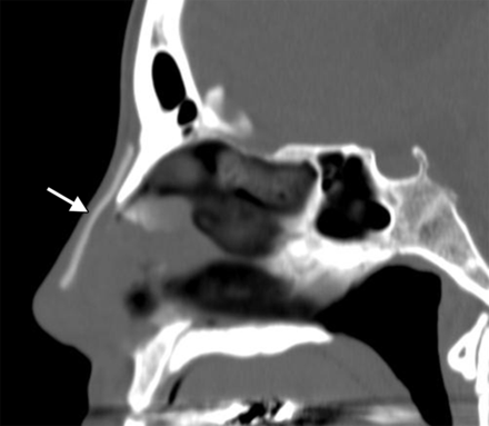 Fig 2.
