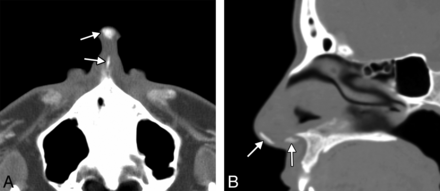 Fig 3.