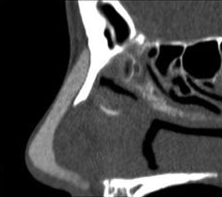 Fig 4.