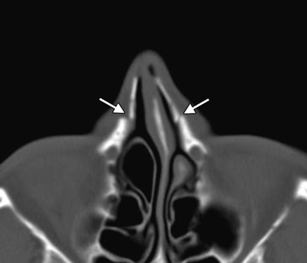 Fig 5.