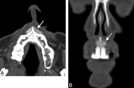 Fig 6.