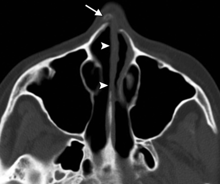 Fig 7.