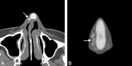 Fig 8.