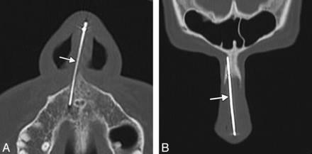 Fig 9.