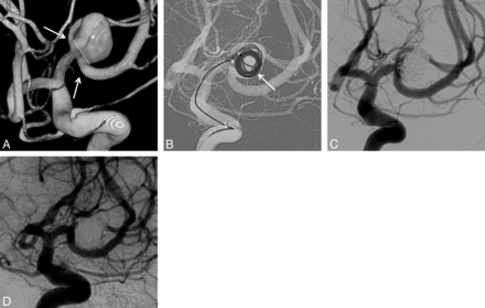 Fig 2.